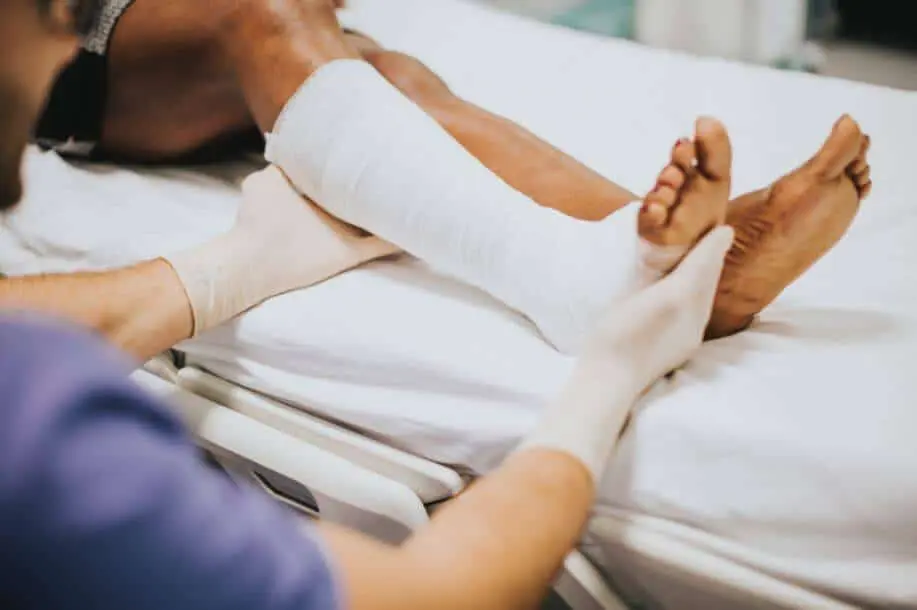 Tips on healing a broken leg