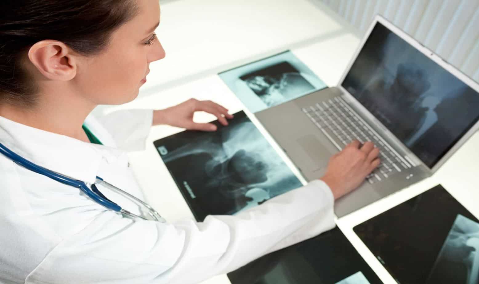female medical doctor looking at x-rays of hip replacement using a laptop